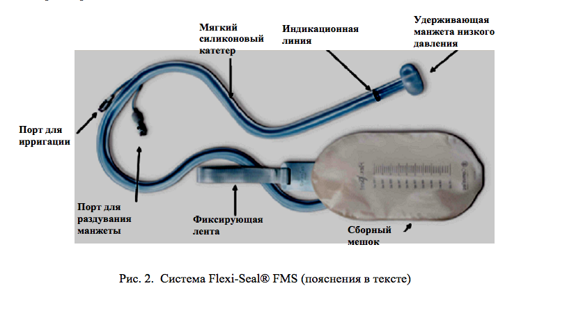 Система Flexi–Seal® FMS